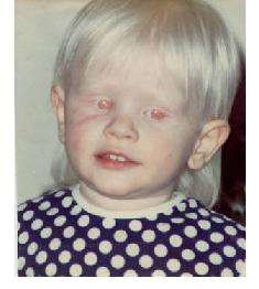 http://grandpacliff.com/Animals/Img-Animals/Img-Albinos/albino-human-caucasion2-b.jpg