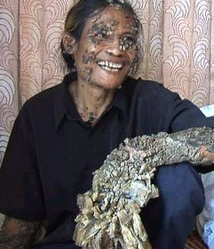 http://www.otrasfronteras.com/archivos/imagenes/hombre-arbol.jpg
