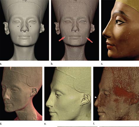 Imágenes de tomografía computerizada que muestran el rostro interior (la segunda de arriba, la primera y tercera de abajo) esculpido bajo el busto de Nefertiti. | 'Radiology'