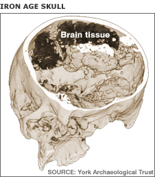 Fossilised brain